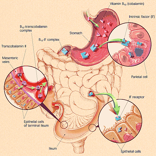 Pernicious Anemia Medlibes Online Medical Library